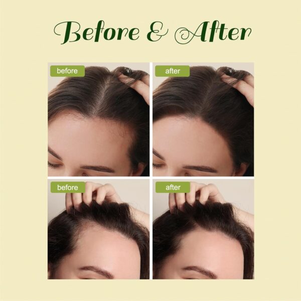 Veganic Hair Growth Oil, Veganic Natural Hair Growth Oil, Ve... - Image 5
