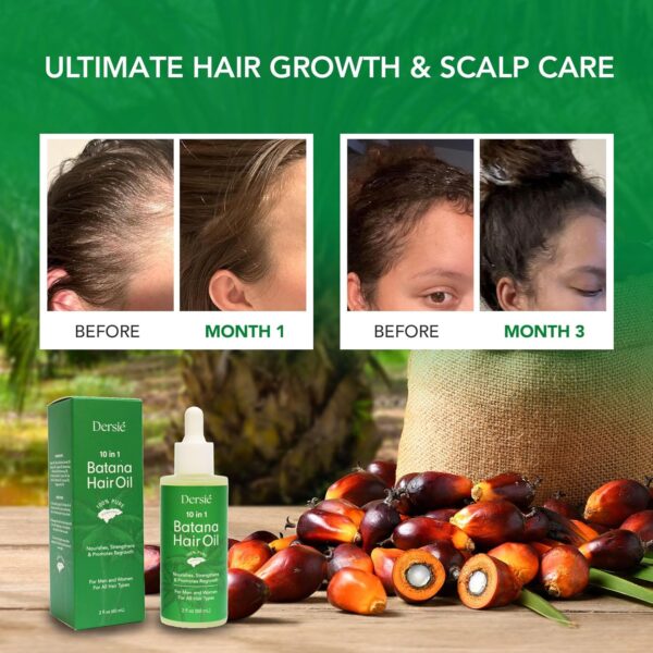 Hair Growth Oil with Batana and Rosemary: 10-in-1 Veganic & ... - Image 6